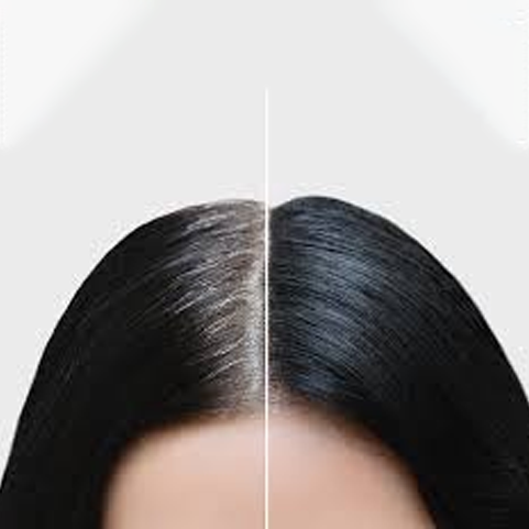 Root Touch up